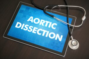 Aortic Dissection Complications